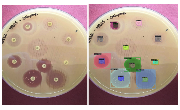 Antibiogram Zone Detector