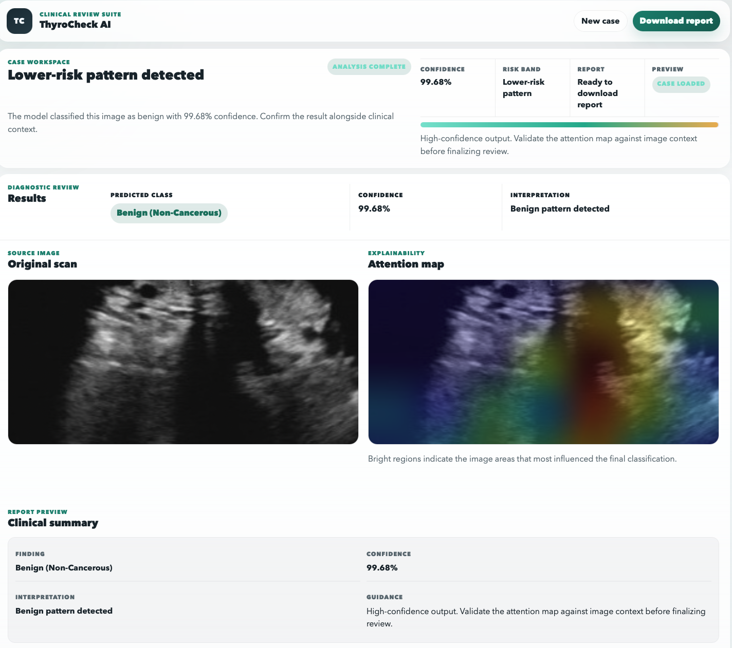 Research Based Thyroid Nodule Classification with Explainable AI